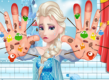 Elsa Hand Doctor